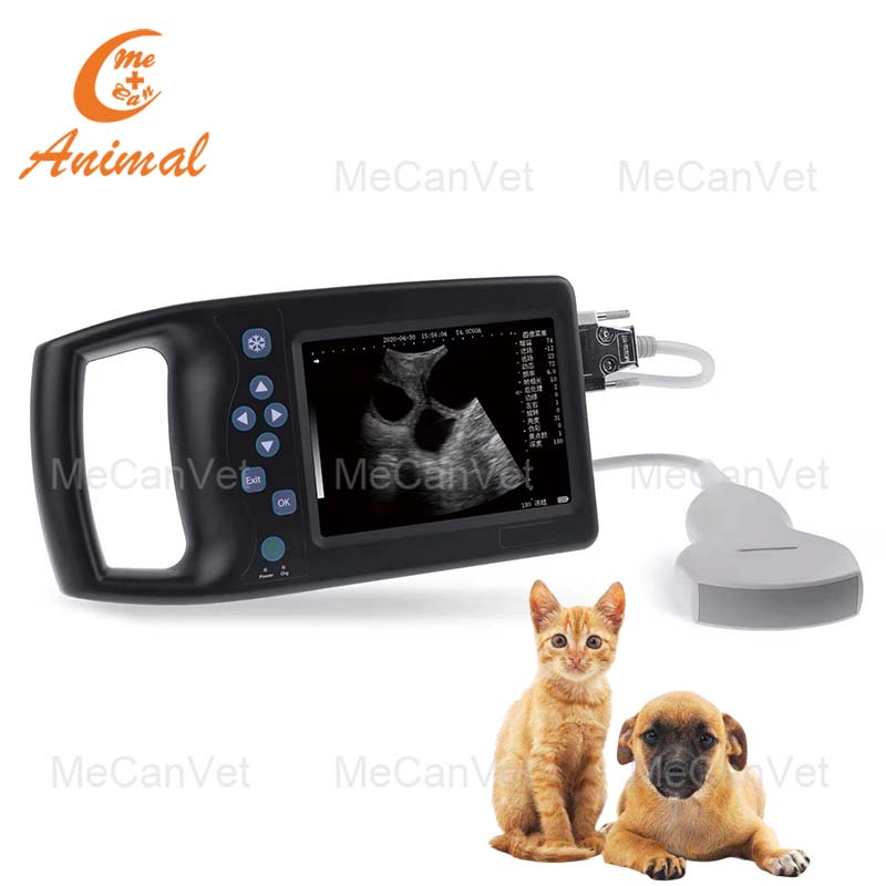 Portable Digital Ultrasound Scanner